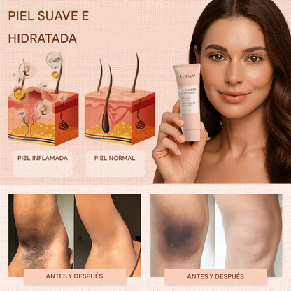 Luhaka® Gel Exfoliante Purificante ACE 3 Para Acantosis Nigricans, Exfoliación, Manchas Oscuras, Acrocordones y Eczema