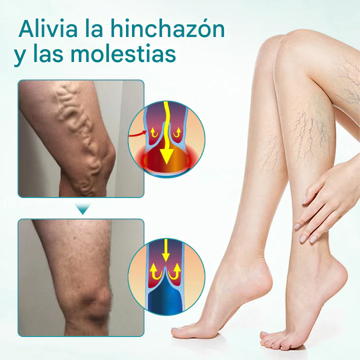 🔥PROMO 2x1 🎁- Crema Para Aliviar Las Venas Timilk® VeinAway