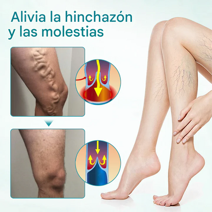 🔥PROMO 2x1 🎁- Crema Para Aliviar Las Venas Timilk® VeinAway