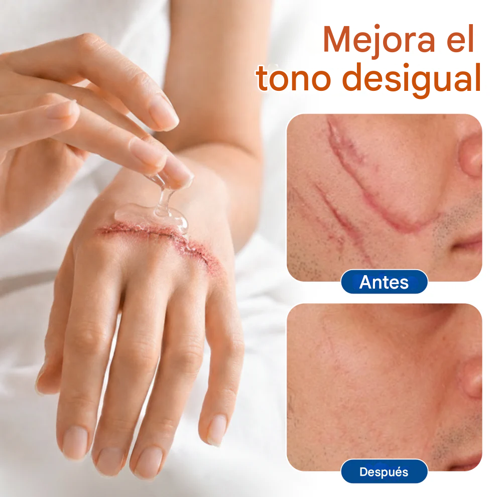 Gel Renovador De La Piel - Timilk