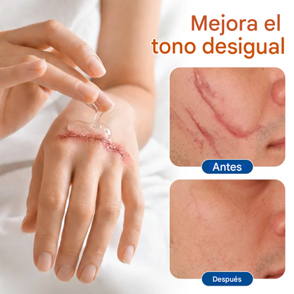 Gel Renovador De La Piel - Timilk