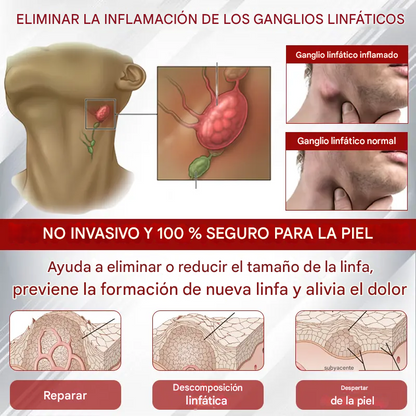 Red Vine ® - Crema De Gel Para Aliviar Los Edemas