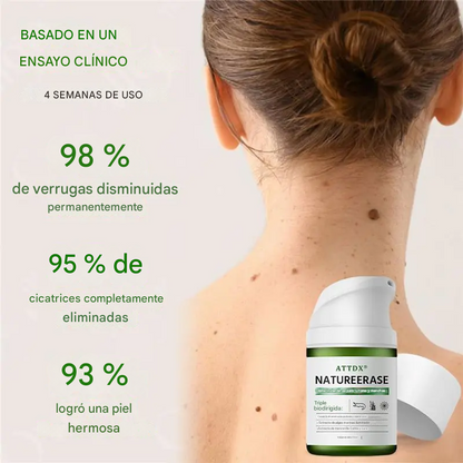 🔥PROMO 2X1🔥 Crema Eliminadora Verrugas, Lunares Y Manchas Con Aceite De Caimán