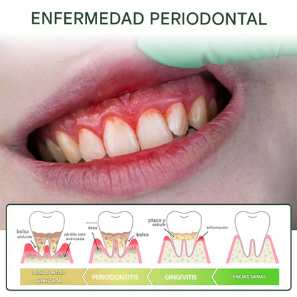 Spray dental Timilk® con aroma a corteza de sauce.