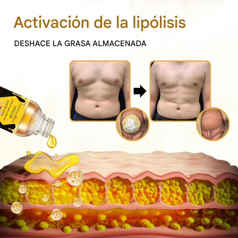 ThermoFirm - Aceite Para Ginecomastia Con Veneno De Abeja