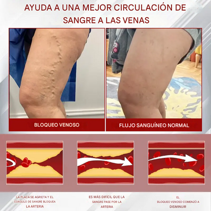 Red Vine ® - Crema De Gel Para Aliviar Los Edemas