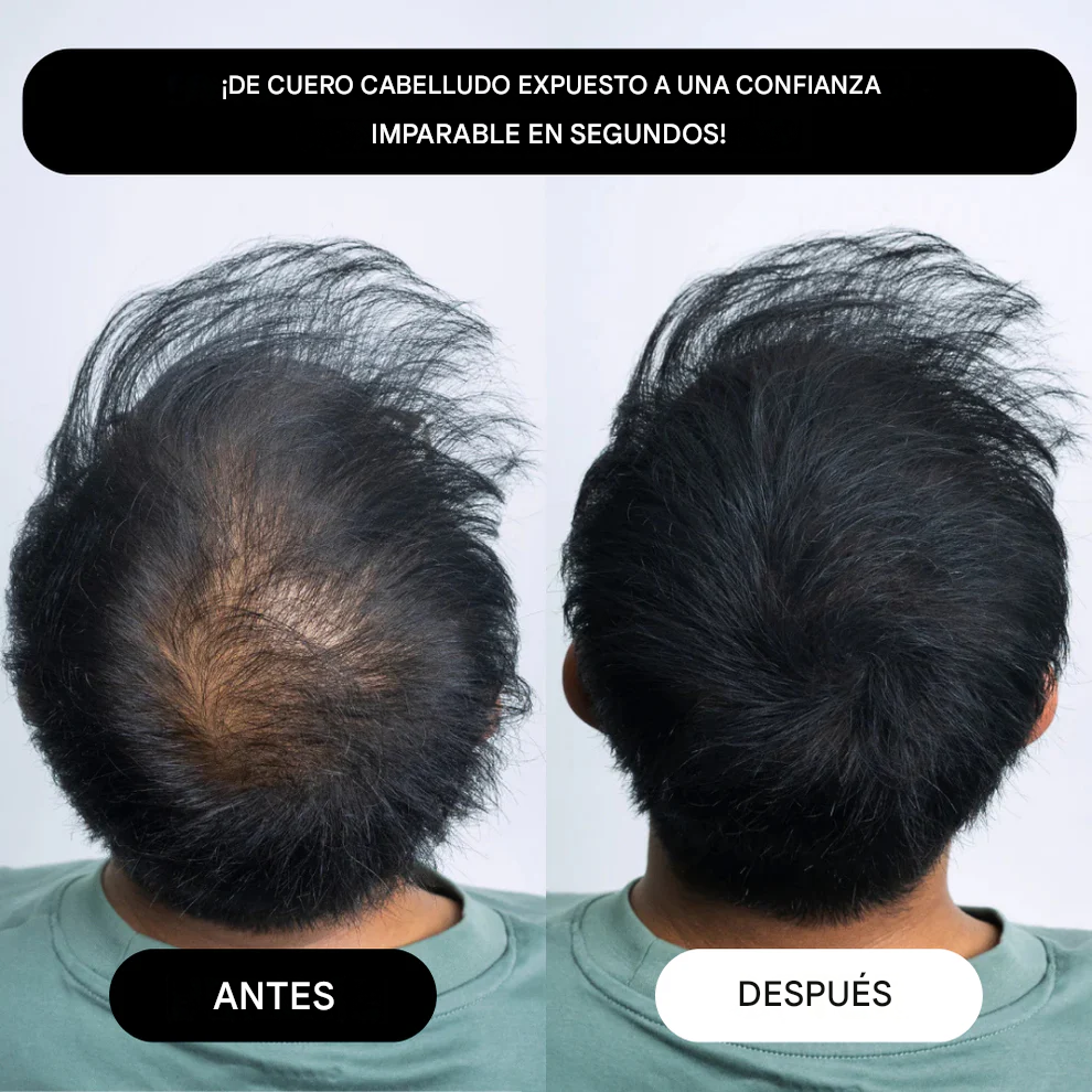 RIZEN™ - Fibra Capilar En Polvo