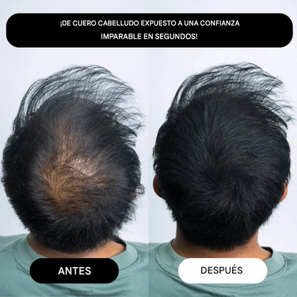RIZEN™ - Fibra Capilar En Polvo