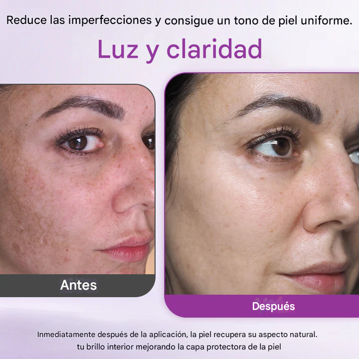 ✨Ceoerty® MelantraX - Esencia Anti Hiperpigmentación