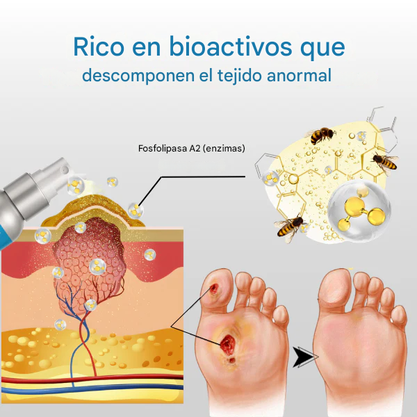 Spray Para El Tratamiento De La Diabetes Con Veneno De Abeja