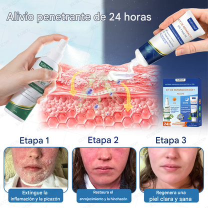 Sistema De Reparación Diurna Y Nocturna Para La Psoriasis: Dúo De Alivio 100 % Libre De Esteroides Para Placas, Descamación Y Picazón.