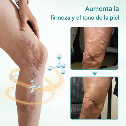 🔥PROMO 2x1 🎁- Crema Para Aliviar Las Venas Timilk® VeinAway