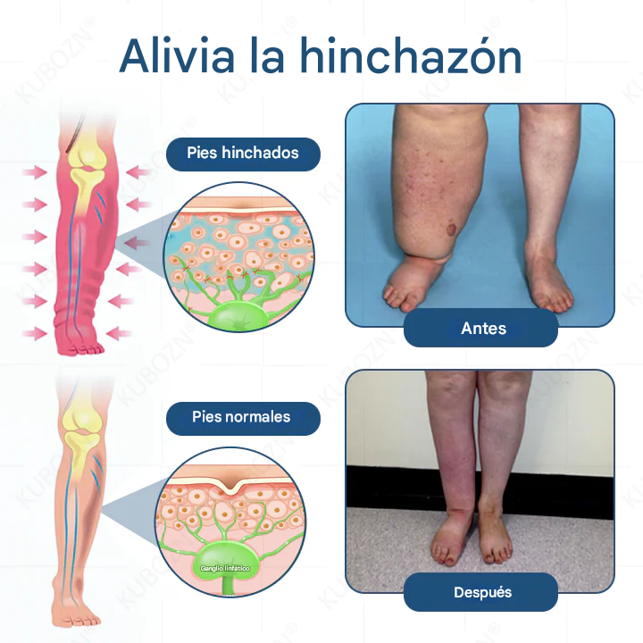 🔥SUPER OFERTA 3x1 🔥Crema Roll-On Con Bomba Para Drenaje Linfático Y Alivio De La Hinchazón