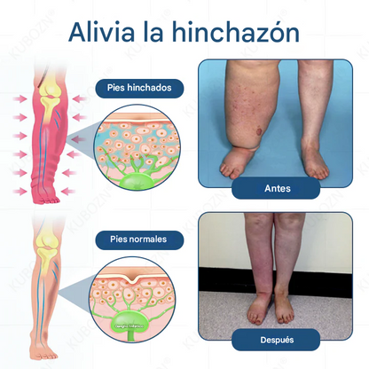 🔥SUPER OFERTA 3x1 🔥Crema Roll-On Con Bomba Para Drenaje Linfático Y Alivio De La Hinchazón