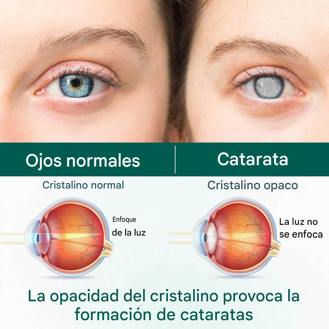 Sérum - OptiClear Nano Eye Roller Serum