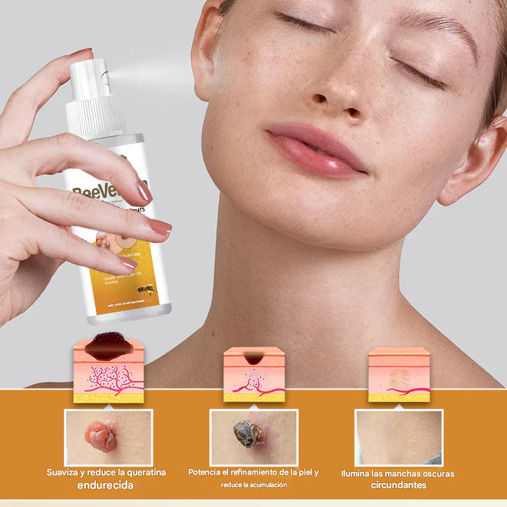 BeeEssence® - Spray Removedor De Verrugas