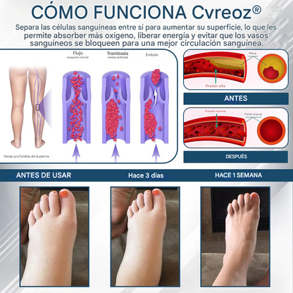 PROMO 2x1 🎁Cvreoz® - Crema De Hierbas Desintoxicante Para Edemas
