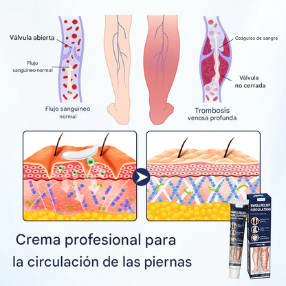 🔥SUPER OFERTA 3x1 🔥Crema Roll-On Con Bomba Para Drenaje Linfático Y Alivio De La Hinchazón
