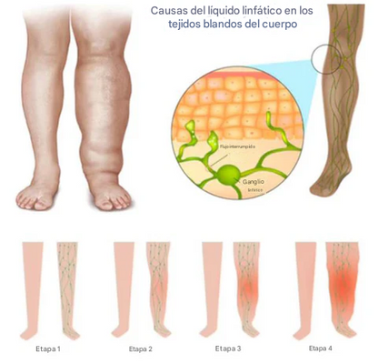 VitaLymph™ - Cuello Ultrasónico Portátil