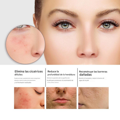 Serum Facial Para Cuidado De La Piel
