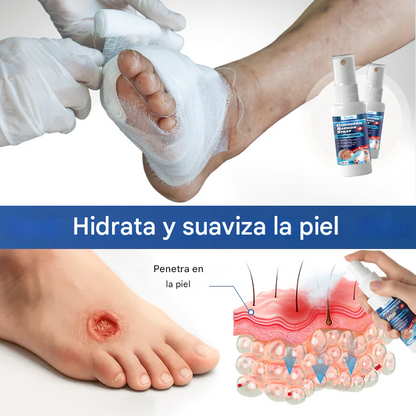 GlucoDerm - Spray De Barrera Diabetic