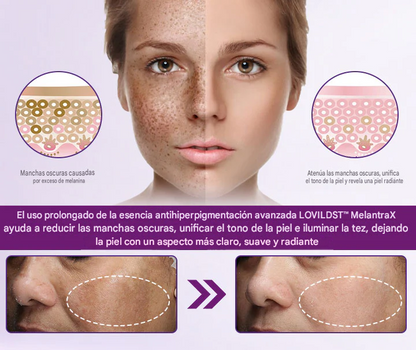 LOVILDS™ MelantraX Esencia Antihiperpigmentación Avanzada