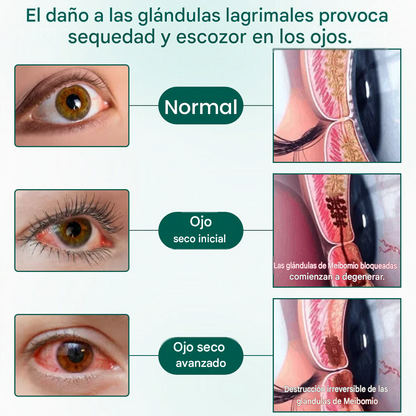 Sérum - OptiClear Nano Eye Roller Serum
