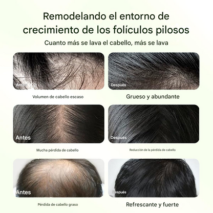 Shampoo De Aceite De Batana Para Crecimiento Del Cabello