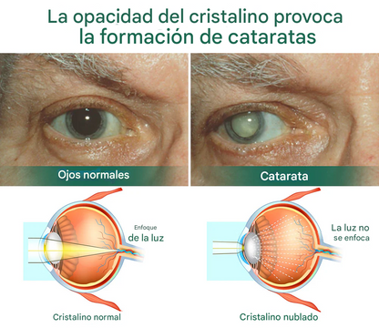 Ourlyard® - Gotas Para Los Ojos - Apto para presbicia, síndrome del ojo seco, glaucoma y cataratas