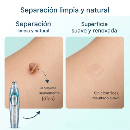 Lápiz De Cuidado Avanzado Para Eliminar Verrugas Y Imperfecciones De La Piel