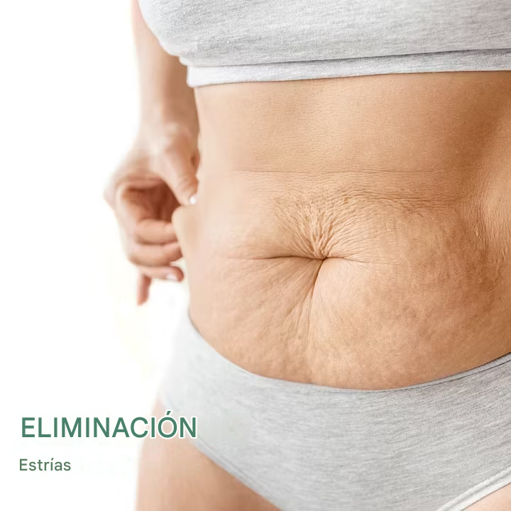 Aceite Corporal Reafirmante Con Colágeno - BeautyWomen