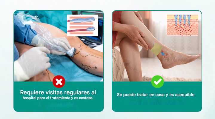 Pack x 24 parches para varices - LegRenew