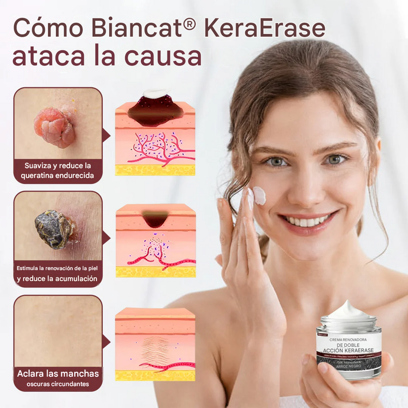 PROMO 2x1 🔥KeraErase ®Crema Eliminadora De Verrugas