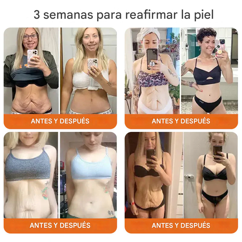 🔥🐝(PROMO 2x1 ) Flysmus™ Suero reafirmante con veneno de abeja y botox🐝🔥