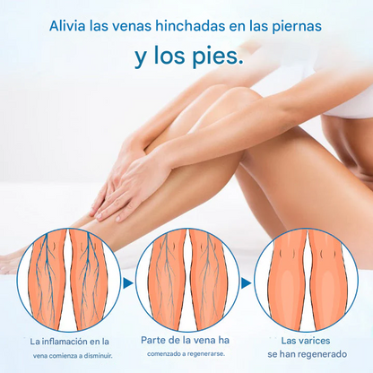Trimil® Spray protector de venas a base de hierbas