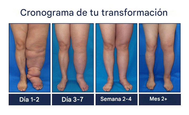 🔥SUPER OFERTA 3x1 🔥Crema Roll-On Con Bomba Para Drenaje Linfático Y Alivio De La Hinchazón