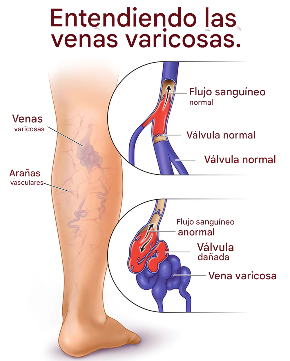 ✨Parche Para Venas Varicosas LOVILDS™ Leech (8 pcs)✨