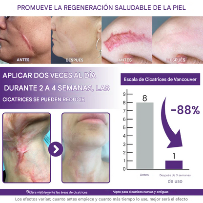 ReGenScar gel reparador de cicatrices (resultados visibles en 7 días)☀️🧴
