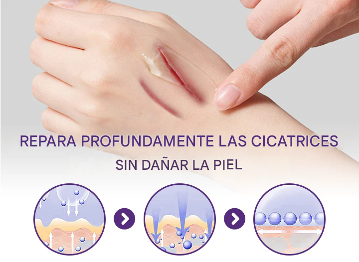 ReGenScar Gel Reparador De Cicatrices (resultados visibles en 7 días)☀️🧴