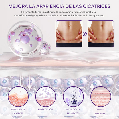 ReGenScar gel reparador de cicatrices (resultados visibles en 7 días)☀️🧴
