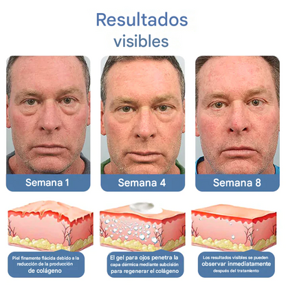OpenEyes - Crema Anti-Ojeras Con Retinol AntiEdad