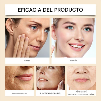 Botox - Crema para eliminar arrugas con Botox y veneno de abeja